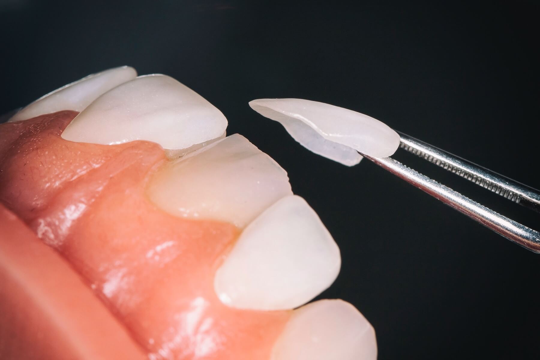 Isotope Crowns