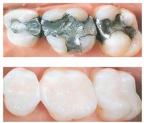 Isotope Fillings